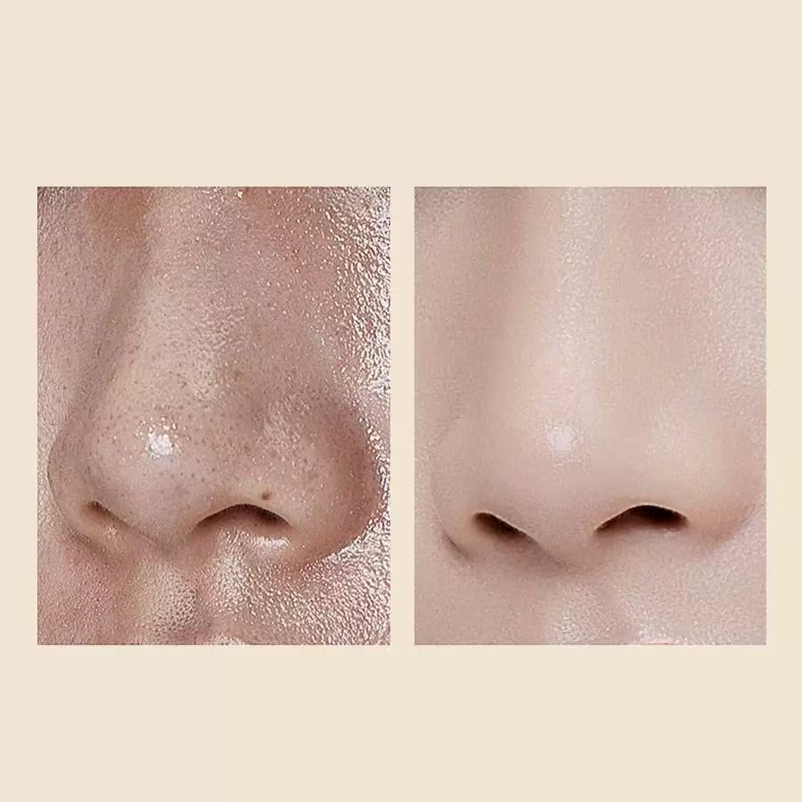 TLOPA® Official Store 🌟 Clear Skin Starts Here!