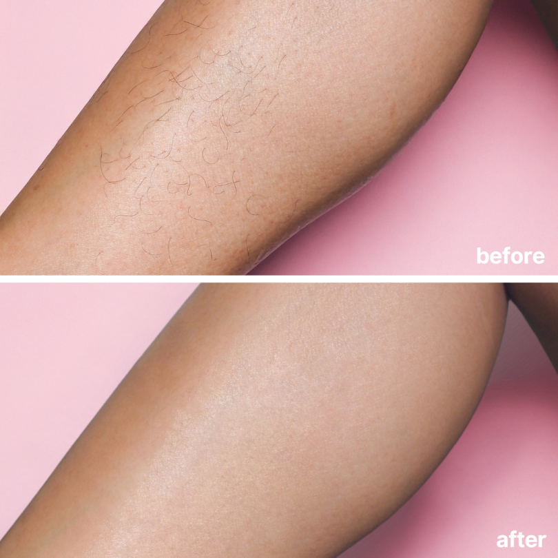 🔥 Final Day 50% OFF 🔥- Official Store💎KINGURR ® Bare Basics No Shave Hair Removal Cream