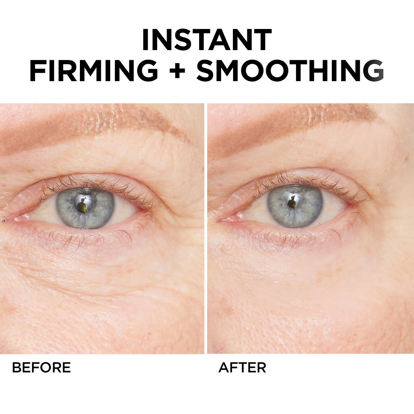 LAST DAY SALE[-77% OFF]🔥Lift & Firm Instant  Face Tightener(✨Keep Skin Young丨Promote Cell Regeneration 🌿Natural Ingredients)