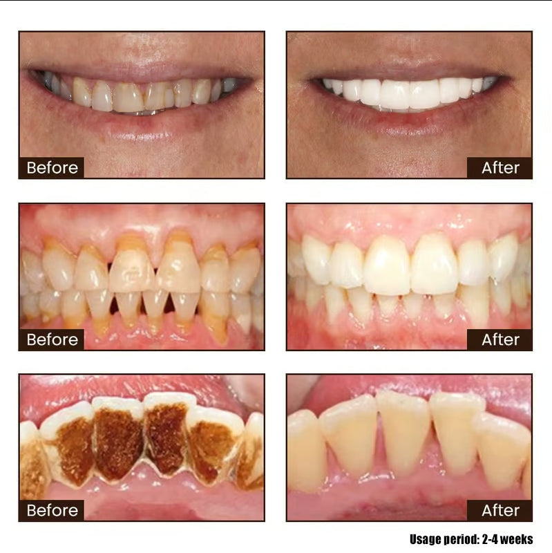 🚨🚨 FLASH SALE: Upgrade to VIP Weight Loss NOW – 50% Off ⏳ (Only 72 Hours Left!)-Niacinamide Whitening Toothpaste-max