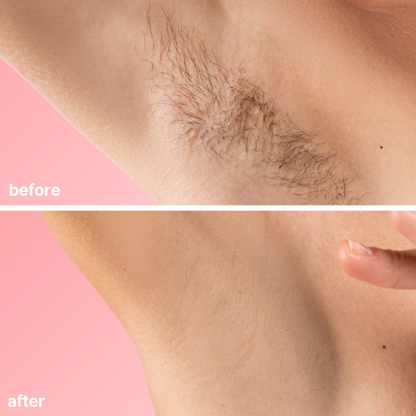 🔥 Final Day 50% OFF 🔥- Official Store💎KINGURR ® Bare Basics No Shave Hair Removal Cream
