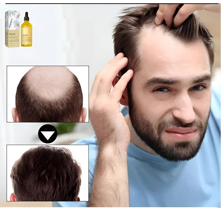 🌸🧧 (Spring Festival Sale – Huge Discounts!) 🐉🎊LOVILDS™ Rosemary Hair Growth Essence – Natural Hair Growth Formula🌱