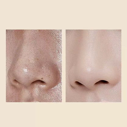 TLOPA® Official Store 🌟 Clear Skin Starts Here!