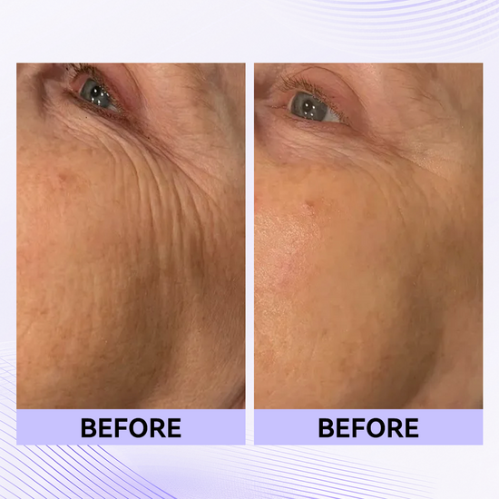 The Vita A Retinal Shot Tightening Booster