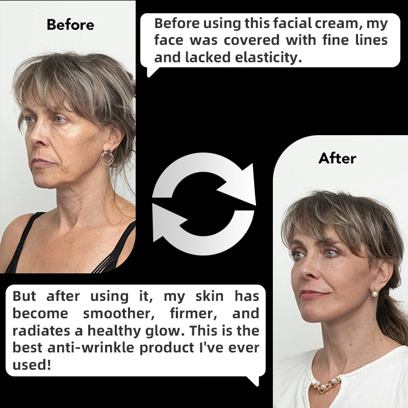 🚨🚨 FLASH SALE: Upgrade to VIP Weight Loss NOW – 50% Off ⏳ (Only 72 Hours Left!)-💎CREAWEL® Multi-Effect Moisturizing & Anti-Aging Cream 2.0