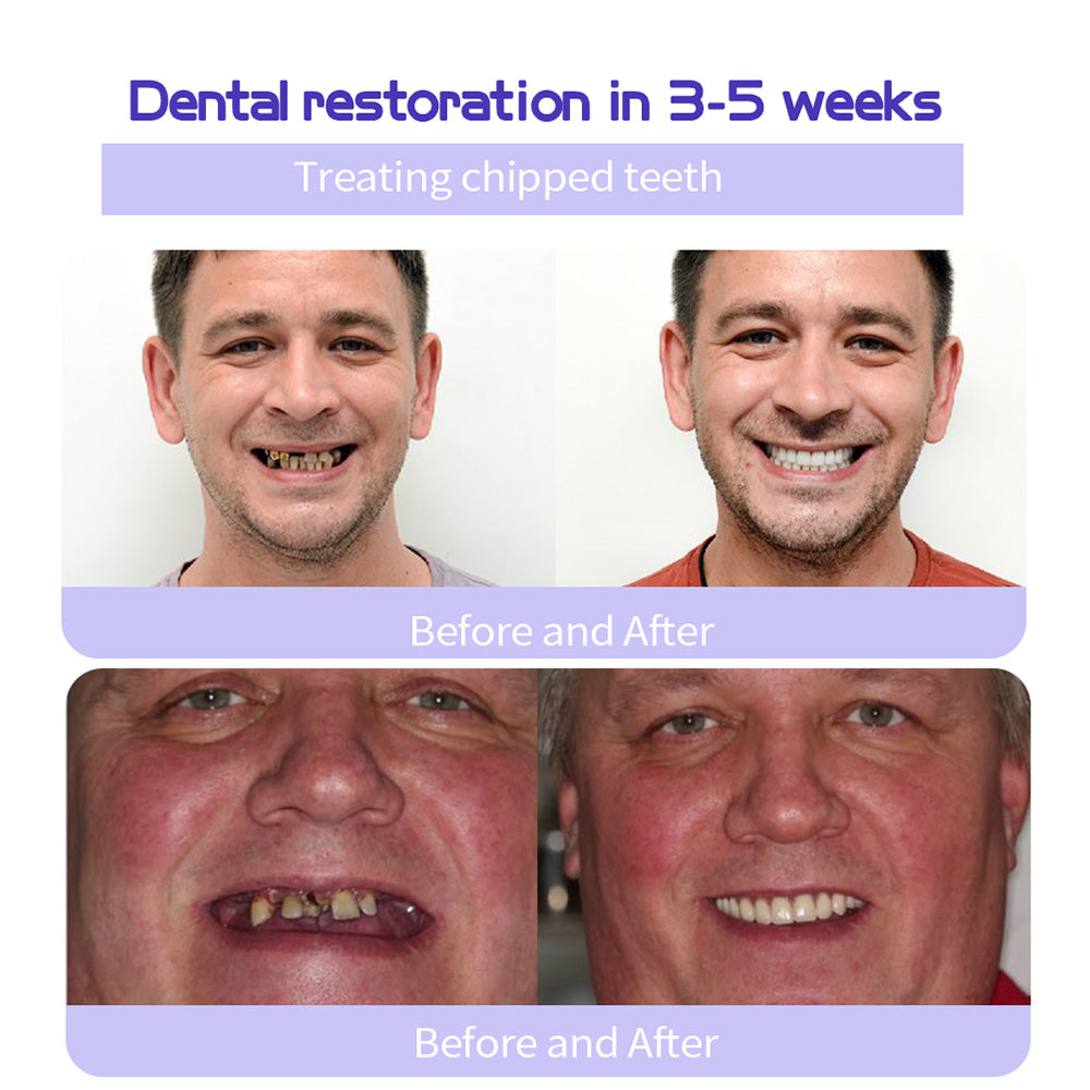 🔥 Final Day 50% OFF 🔥- Official Store💎 Refesy Solid Teeth -BIKENDA®  brightening Toothpaste Tablets
