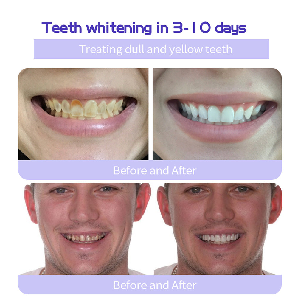 🔥 Final Day 50% OFF 🔥- Official Store💎 Refesy Solid Teeth -BIKENDA®  brightening Toothpaste Tablets