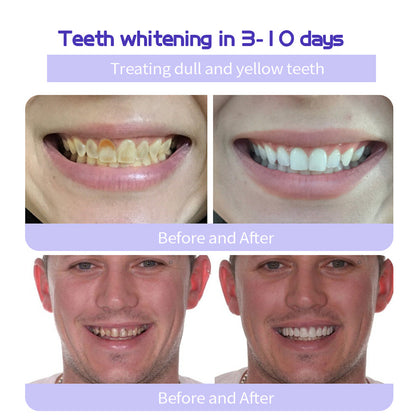🔥 Final Day 50% OFF 🔥- Official Store💎 Refesy Solid Teeth -BIKENDA®  brightening Toothpaste Tablets