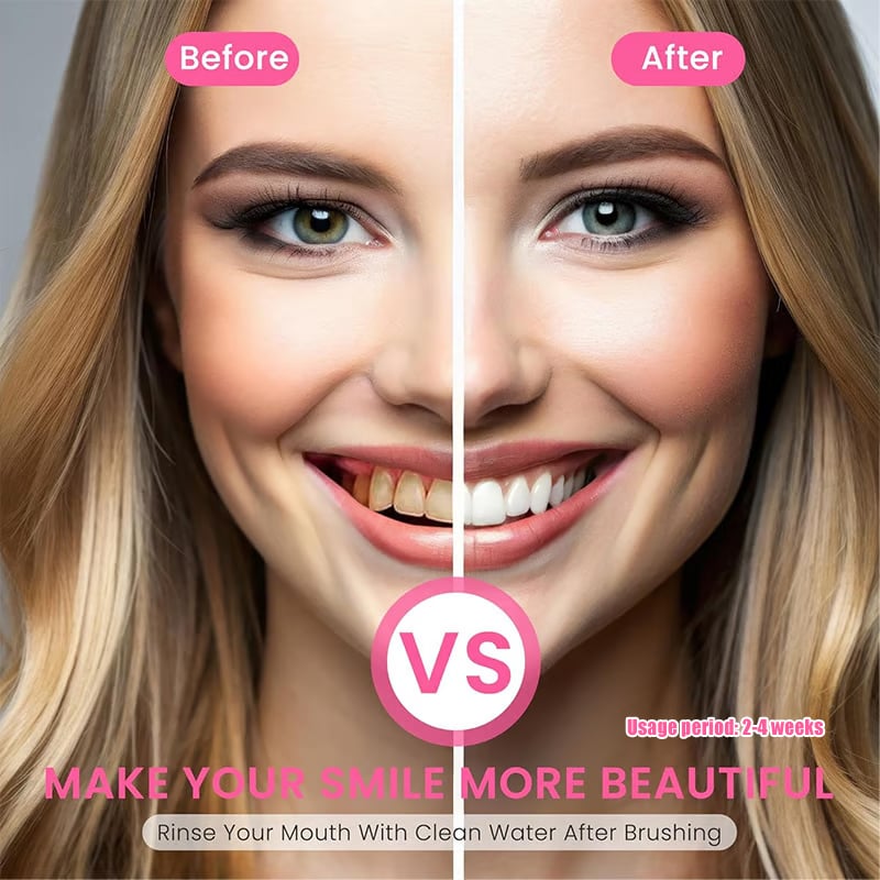🚨🚨 FLASH SALE: Upgrade to VIP Weight Loss NOW – 50% Off ⏳ (Only 72 Hours Left!)-Niacinamide Whitening Toothpaste-max