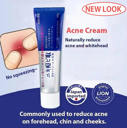 [👨‍⚕️Official Store] Acne Cream (✔️Anti-allergic ✔️Skin-friendly ✔️ Easily absorbed ✔️ Fast results)