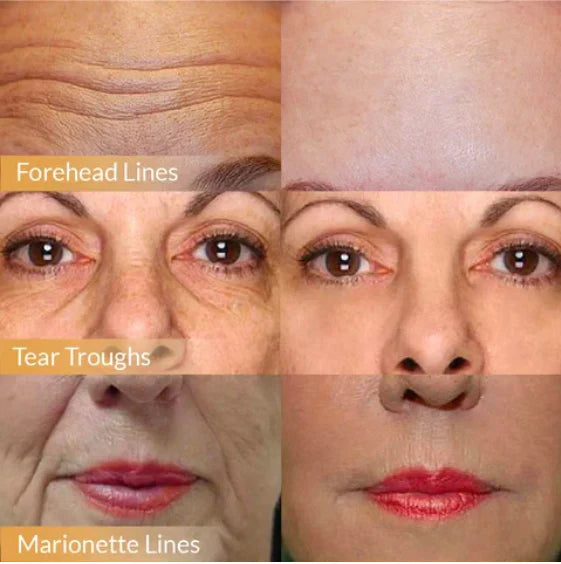 🚨🚨 FLASH SALE: Upgrade to VIP Weight Loss NOW – 50% Off ⏳ (Only 72 Hours Left!)-💎CREAWEL® Multi-Effect Moisturizing & Anti-Aging Cream 2.0