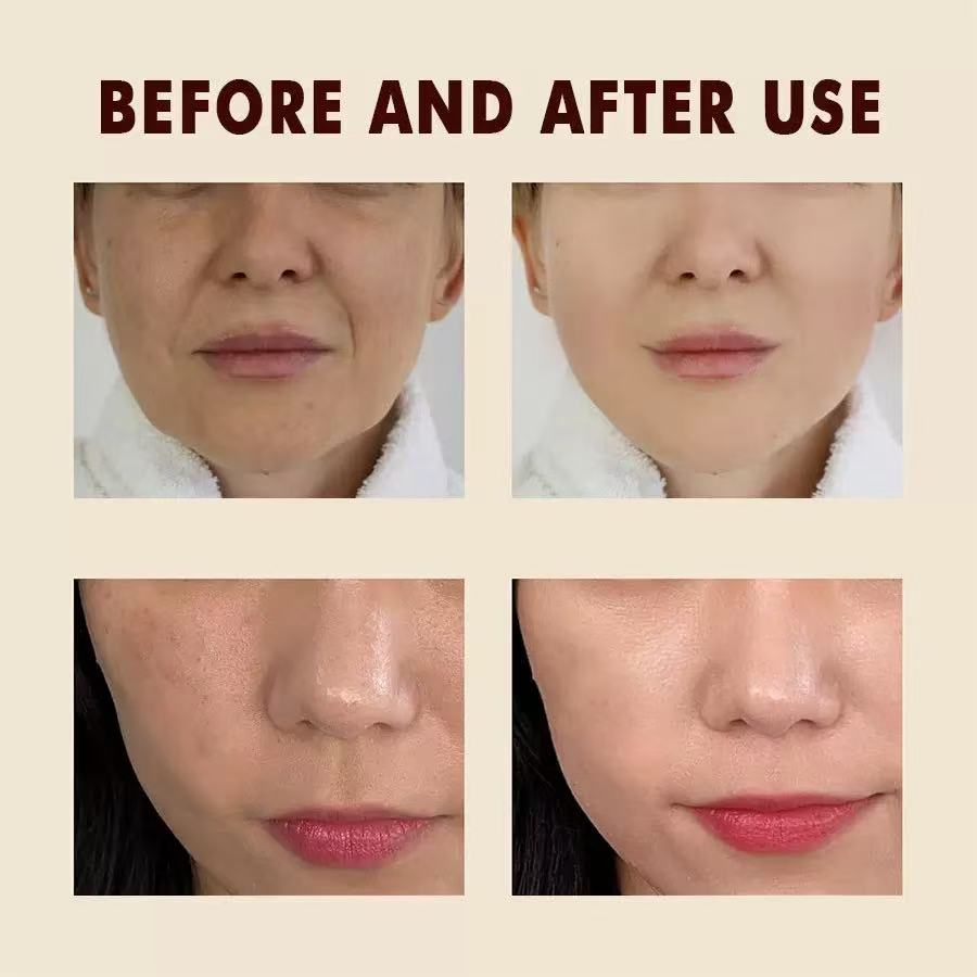 TLOPA® Official Store 🌟 Clear Skin Starts Here!