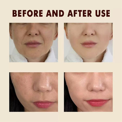 TLOPA® Official Store 🌟 Clear Skin Starts Here!